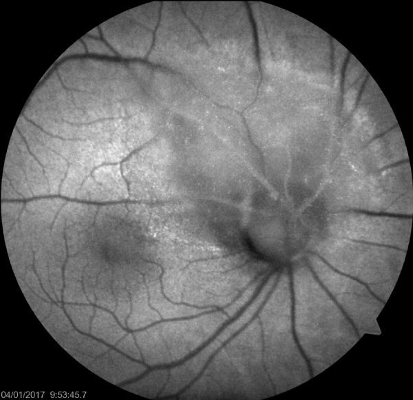 Mushuk sikish suratlari